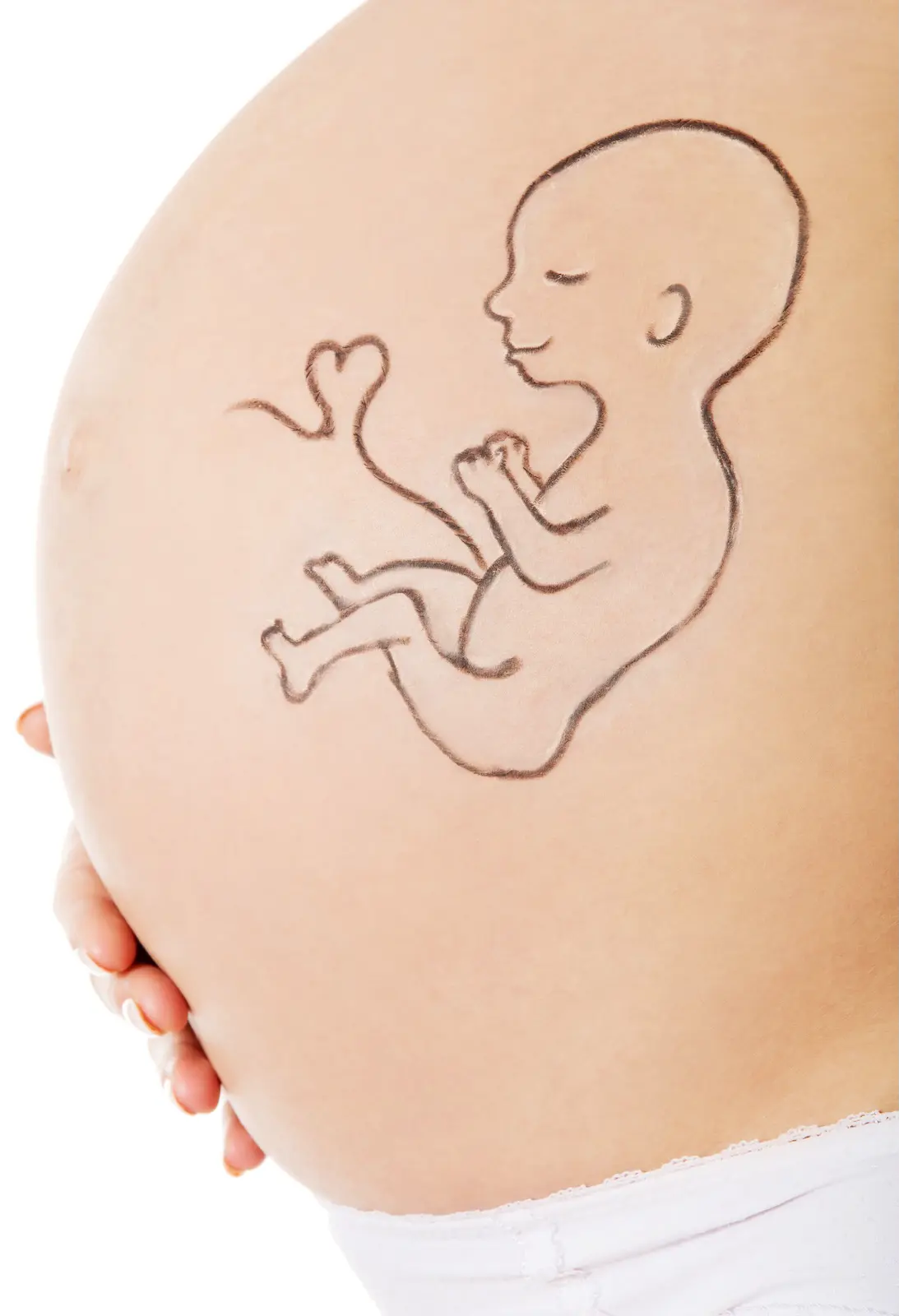 Beckenendlage einer Schwangerenfrau mit aufgemalten Baby auf dem Babybauch